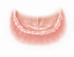 Отсутствие зубов имплантация